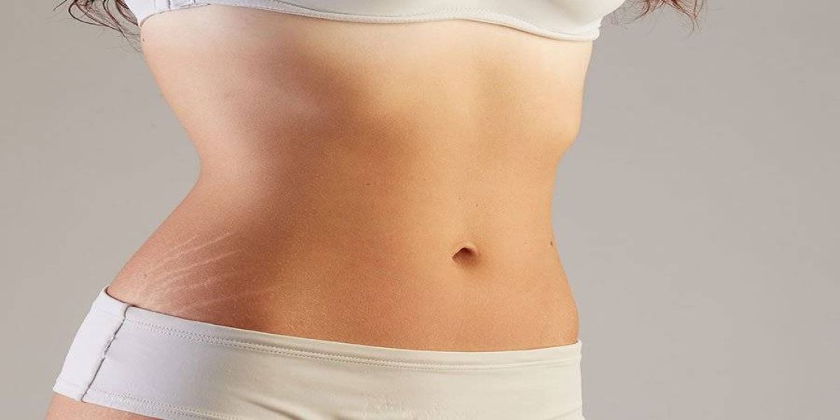 Camuflagem estética se torna aliada no resgate da autoestima