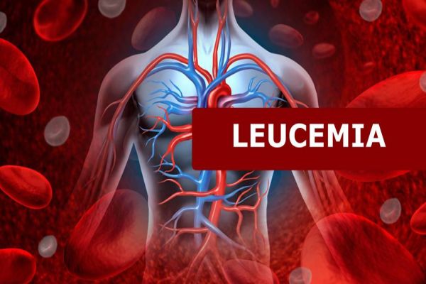 Leucemia pode ser diagnosticada por exame de sangue? Conheça os 7 mitos e verdades da doença!