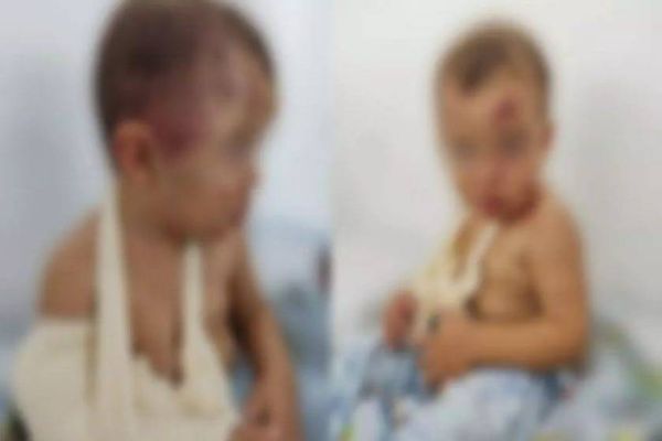 Mãe é presa suspeita de tortura após filho de 2 anos ser hospitalizado com várias lesões