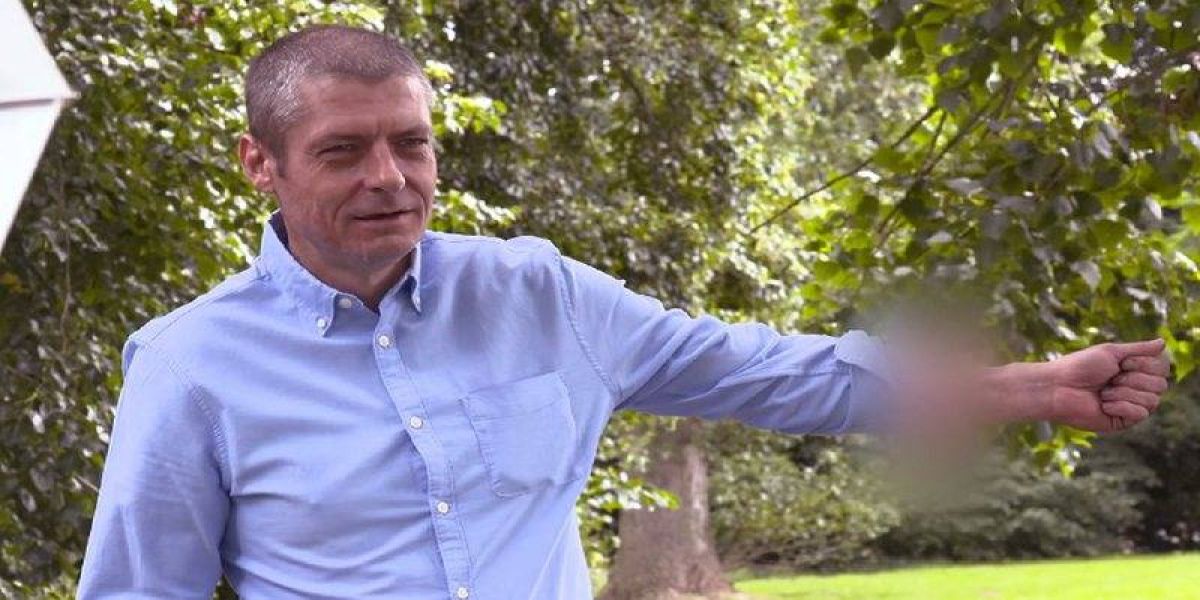 Inacreditável: Homem passou seis anos com um pênis implantado no braço