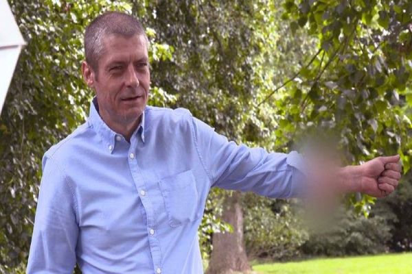 Inacreditável: Homem passou seis anos com um pênis implantado no braço