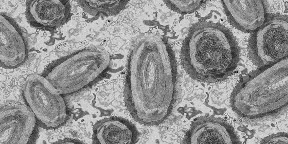 Primeiro caso da varíola dos macacos em humanos é confirmado no Brasil