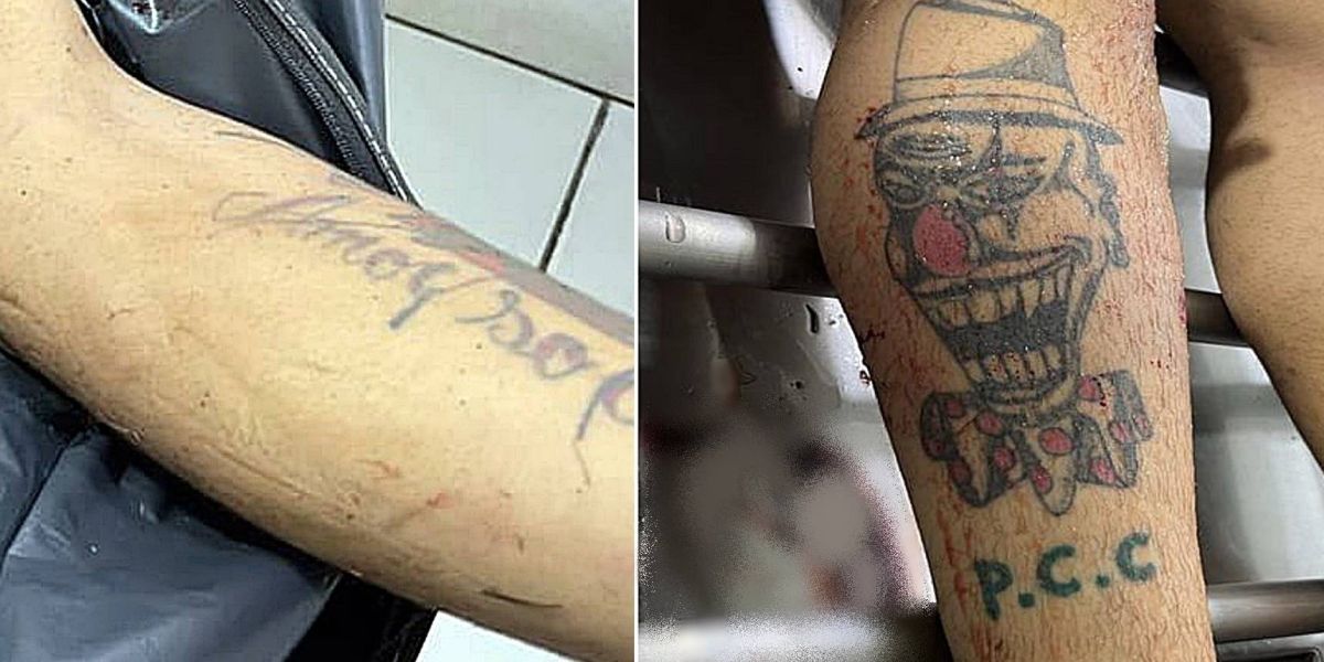 Vítima de atropelamento na BR-277, segue sem identificação; Tatuagens podem auxiliar