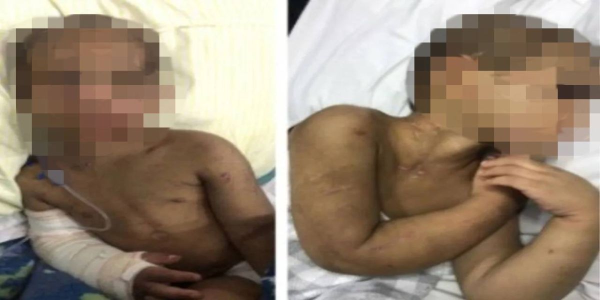 Menino tem oito costelas fraturadas após ser espancado pela mãe e pelo padrasto por 'bagunçar'