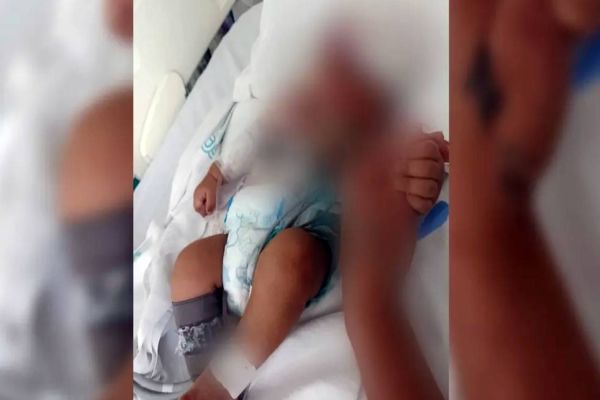 Bebê morre após pai jogar celular nele ao tentar atingir a mulher em Valparaíso de Goiás