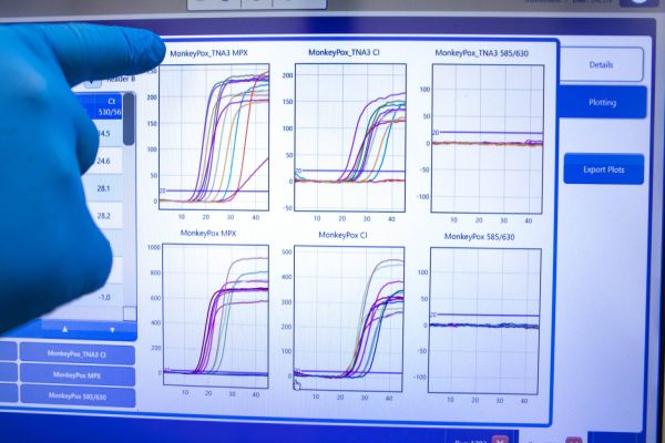 Paraná registra mais 11 casos de Monkeypox