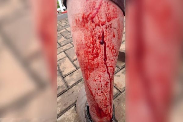 Idoso de 72 anos é atacado por oito cães no Bairro Esmeralda