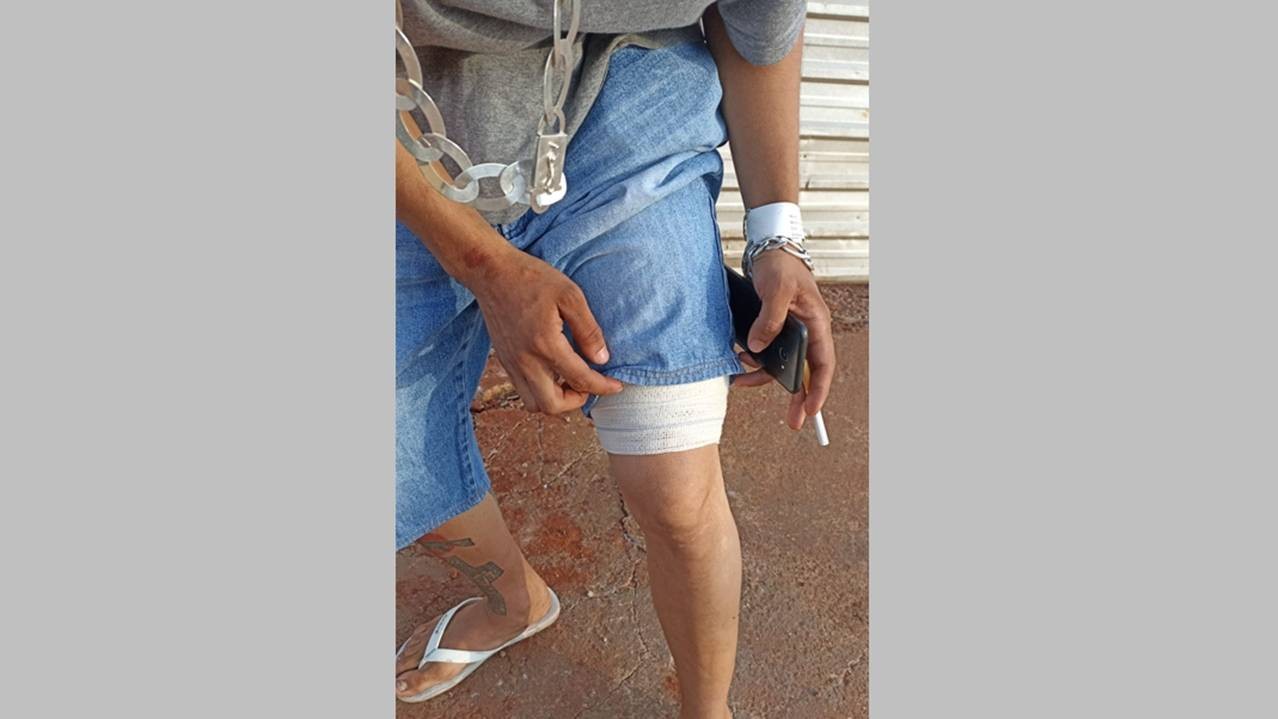 Jovem pede ajuda na UPA Brasília, após ser alvejado por um projétil de arma de fogo na coxa