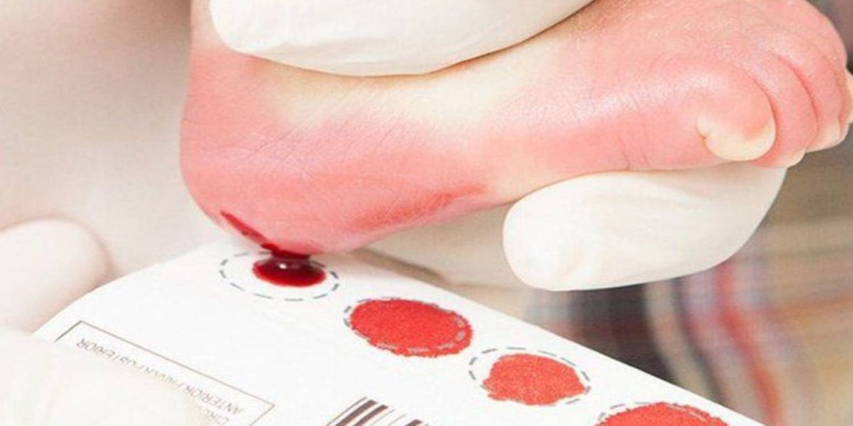 Câmara dos Deputados aprova obrigatoriedade de Hospitais em orientar pais sobre o teste do pezinho