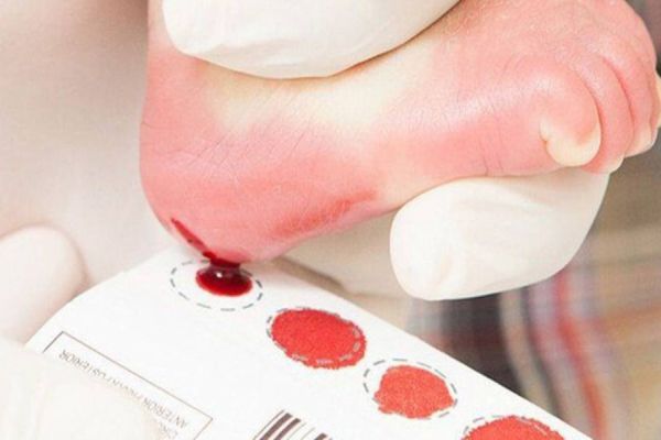 Câmara dos Deputados aprova obrigatoriedade de Hospitais em orientar pais sobre o teste do pezinho