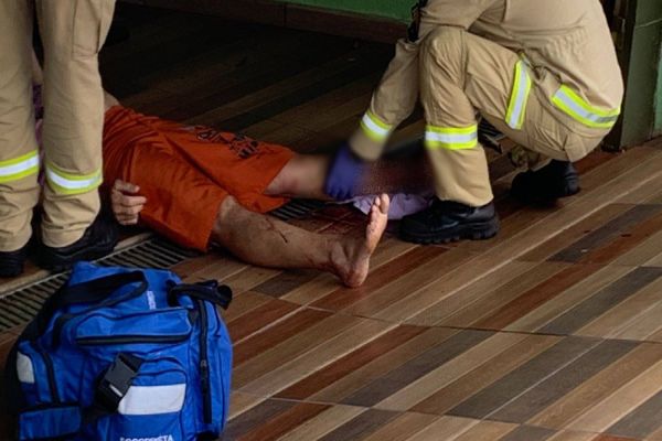Imagem referente a notícia: Motociclista tem fratura exposta na perna esquerda após queda de moto no Bairro Morumbi