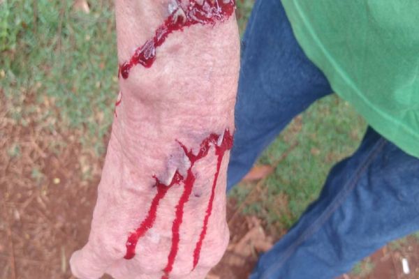 Imagem referente a notícia: Idoso é atacado por dois cachorros na Rua Presidente Bernardes; Moradores estão preocupados