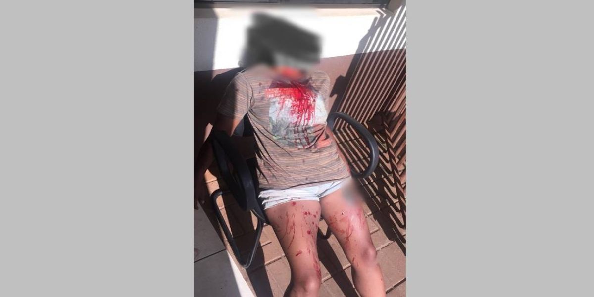 Mulher de 37 anos pede ajuda na UPS Norte após ser violentamente agredida no Bairro Interlagos