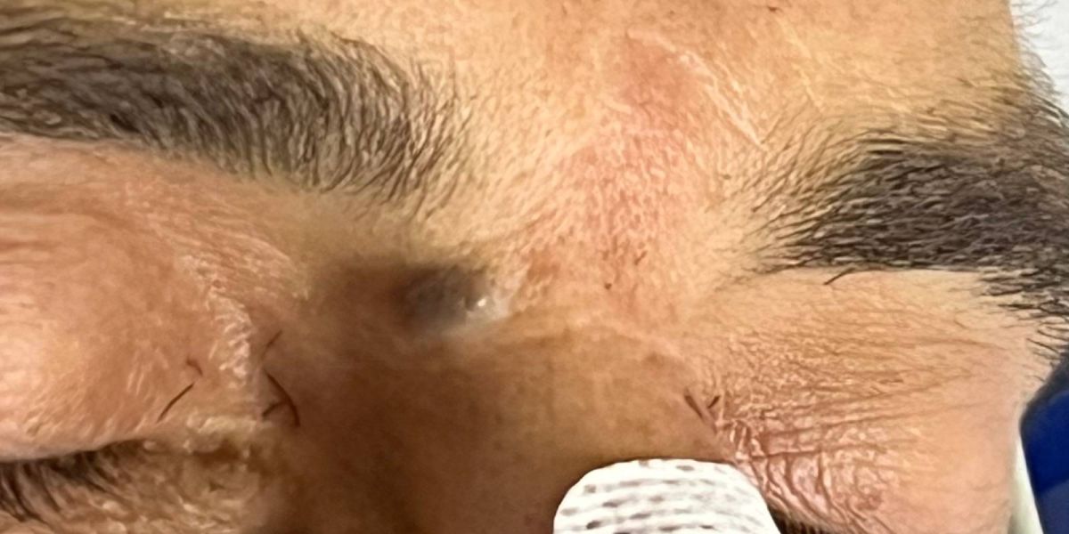 HUOP pede auxílio para identificar paciente que foi esfaqueado no Centro de Cascavel