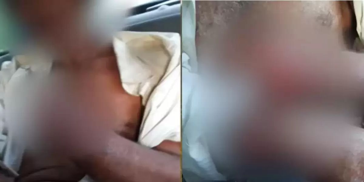 Idoso tem a mão decepada por fazendeiro por dívida de R$ 300 no Paraná; entenda