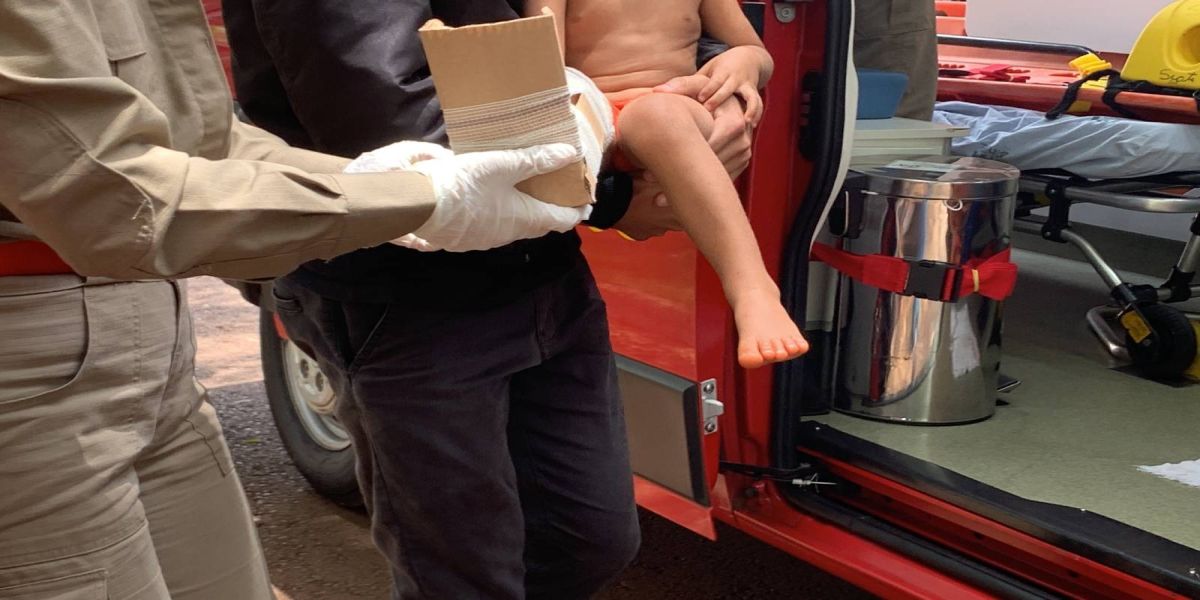 Criança de três anos sofre suspeita de fratura em perna após ser atropelada no Bairro Cascavel Velho