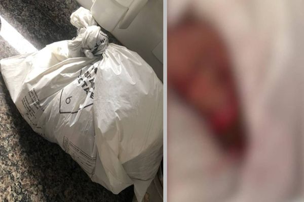 Imagem referente a notícia: Familiares se chocam ao receberem pé amputado em sacola durante velório em Cascavel