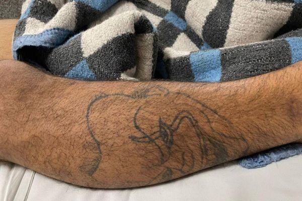 Hospital Universitário pede ajuda para identificar vítima de disparo de arma de fogo