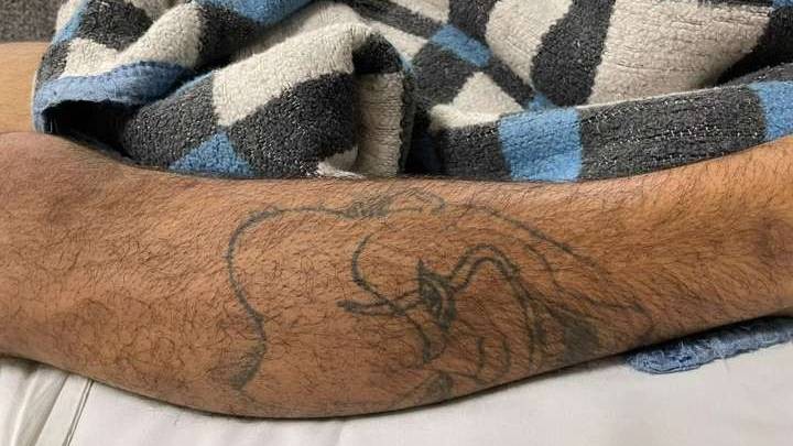 Homem morre após ser baleado na cabeça no Bairro Brasília; Vítima segue sem identificação