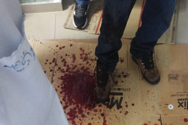 Homem invade casa de ex-esposa, se corta com vidro e acaba detido pela Guarda Municipal