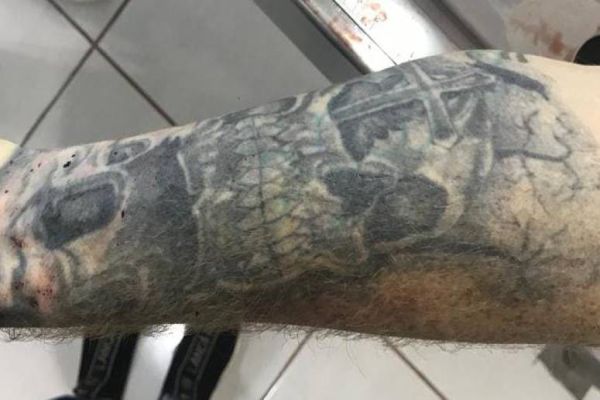 Polícia Civil divulga fotos de tatuagens para identificar vítima de homicídio no bairro Esmeralda