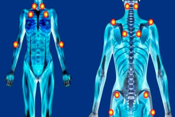 Nova lei dará a Cascavel uma política pública para as pessoas com fibromialgia