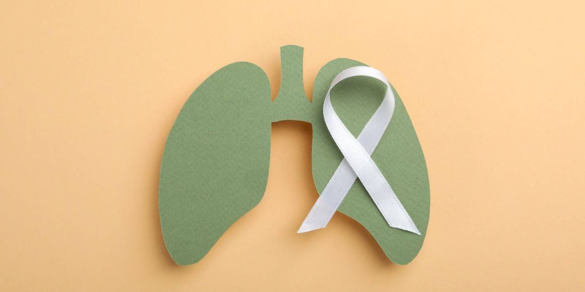 Câncer de Pulmão: diagnóstico precoce reduz riscos