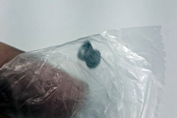 Mulher é ferida por disparo de arma de pressão no Bairro Morumbi