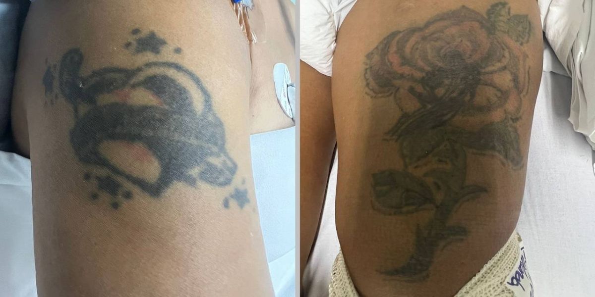 HUOP pede ajuda para identificar mulher que se envolveu em acidente