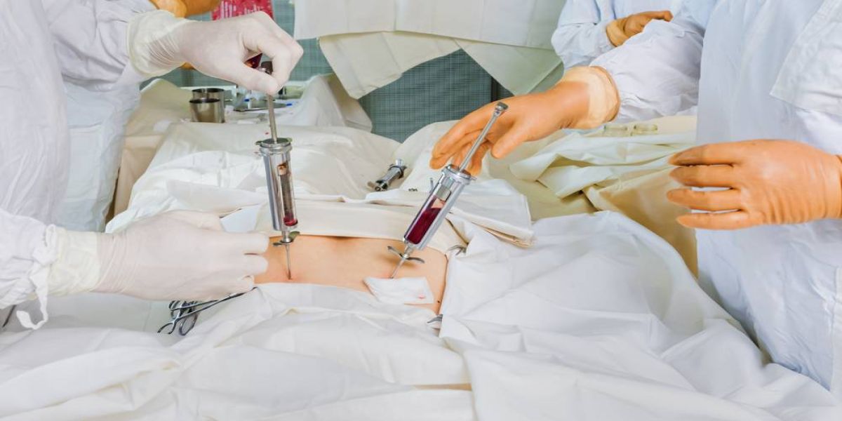 Doação de medula óssea: pessoas de 18 a 35 anos podem ajudar a salvar vidas