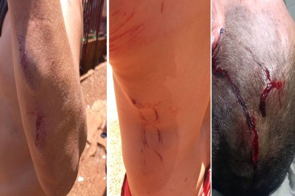 Sogro é agredido na cabeça pelo genro durante conflito familiar no Bairro Presidente