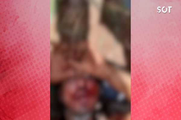 Homem acusado de praticar furtos no Bairro Santa Felicidade é linchado por populares