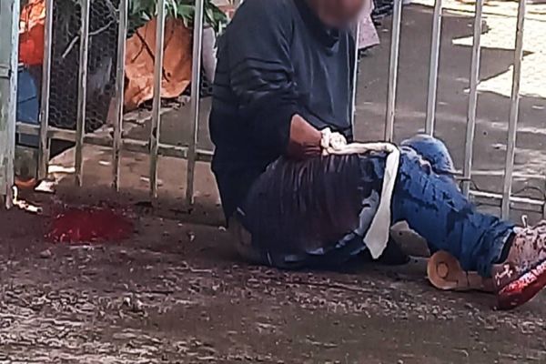 Imagem referente a notícia: Agressão brutal: Homem tem amputação parcial da mão no Bairro Cascavel Velho