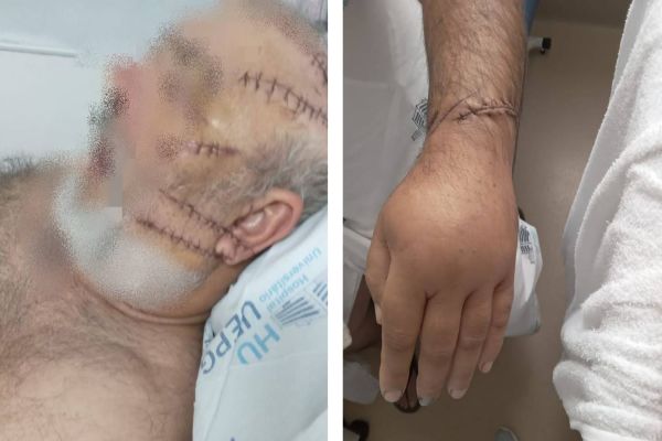 Polícia prende três suspeitos de tentar matar caminhoneiro a golpes de facão enquanto ele dormia