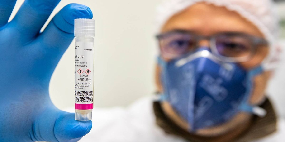 Em seis meses, Lacen processa 13.298 amostras de vírus respiratórios