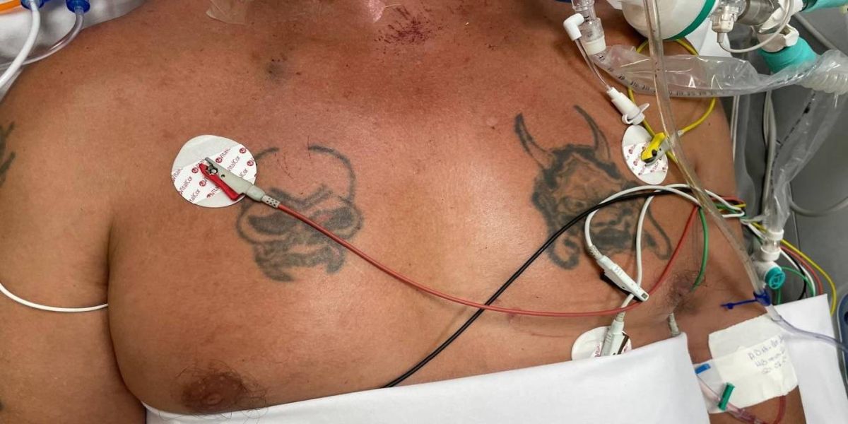 HUOP pede ajuda para identificar homem vítima de acidente em Santa Helena