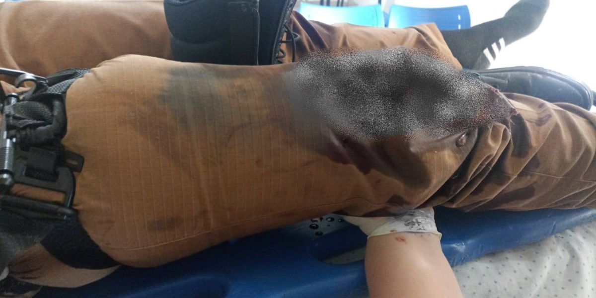 Policial Militar é atingida por um disparo acidental de Calibre .12 em seu próprio joelho em Mamborê