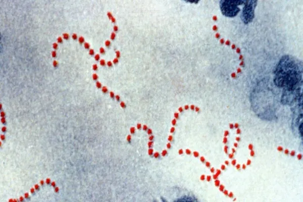 Foto relacionada a notícia: Surto de Streptococcus causa mortes e preocupa moradores da região oeste do Paraná