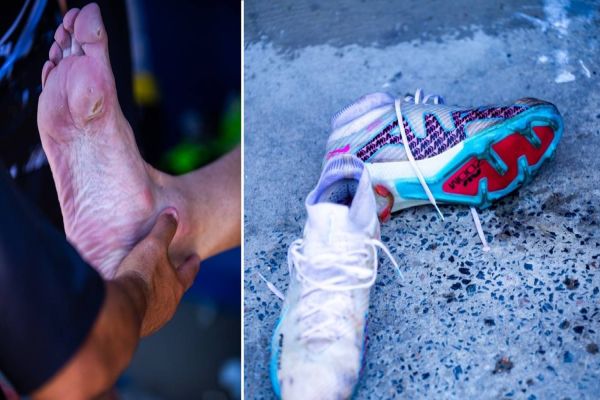 FC Cascavel diz que equipe foi obrigada a jogar em condições desumanas