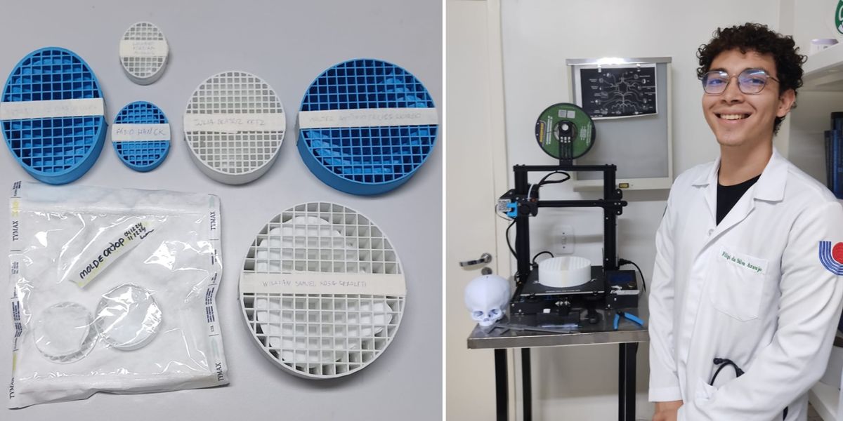 Tecnologia: HUOP realiza primeira cirurgia craniana com molde criado em impressora 3D