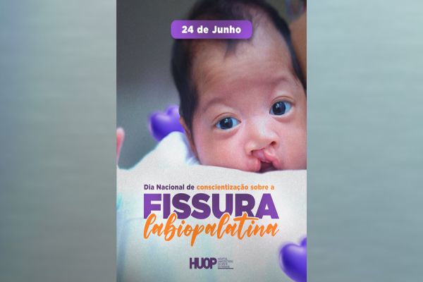 Dia Nacional de Conscientização sobre a Fissura Labiopalatina é comemorado no HUOP com Festa Junina