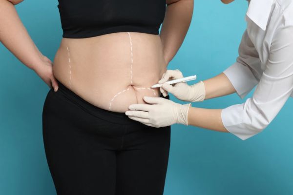 Imagem referente a notícia: Bariátrica: a esperança de quem luta por saúde