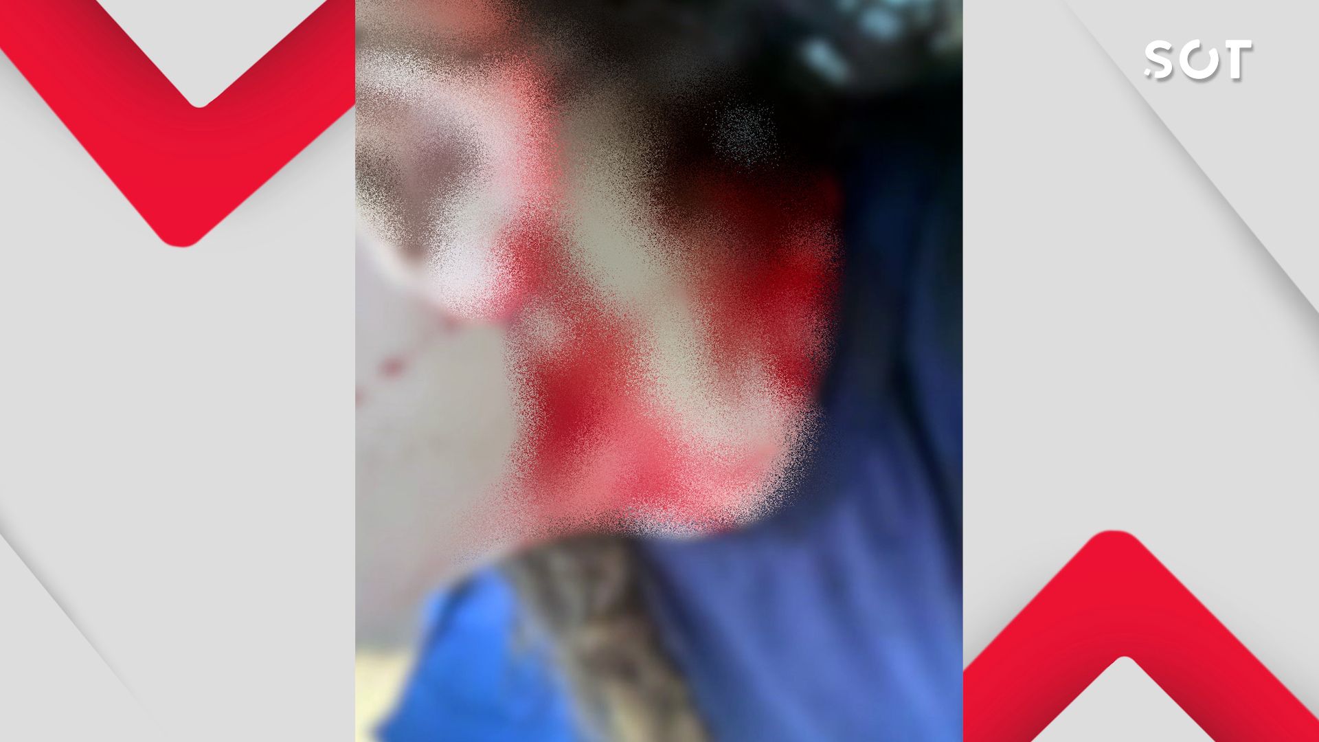 Adolescente sofre tentativa de sequestro a caminho da escola no Bairro Interlagos em Cascavel