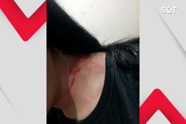 Pitbull ataca jovem que tentou esfaquear a própria irmã na região Norte de Cascavel