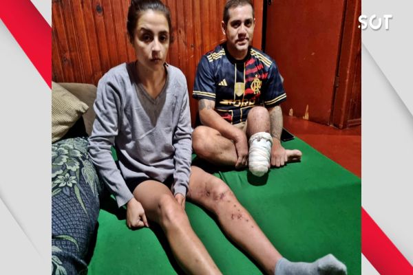 Imagem referente a notícia: Ajude Fernando e Pâmela a recomeçar após grave acidente na Rua do Cowboy em Cascavel