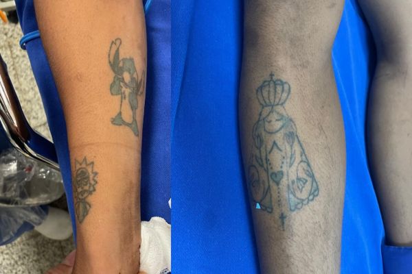 Jovem sem documento é internado após ser socorrido pelo Siate; HUOP pede ajuda para identificar