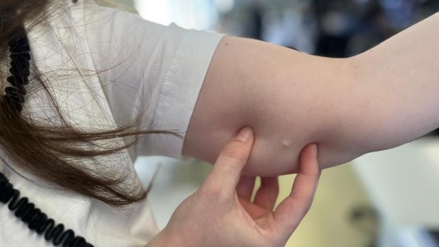 Procura por implante contraceptivo cresce 118% no SUS do Paraná em 2025