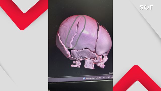 Imagem referente a notícia: Bebê de 2 meses é internado em estado grave e polícia investiga suspeita de agressão no Paraná