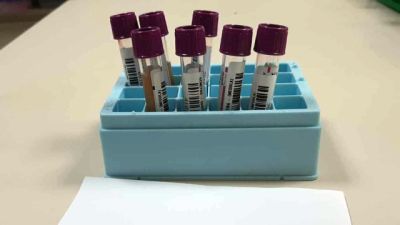 Imagem referente a notícia: Fevereiro Laranja: mês da conscientização sobre leucemia reforça importância do diagnóstico