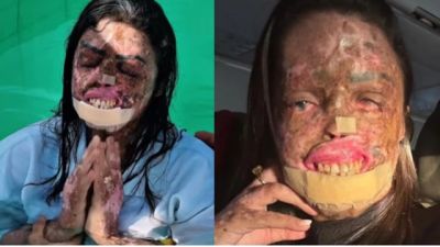 Imagem referente à notícia: Influenciadora Káh Felipe morre aos 31 anos após luta contra doença rara e câncer